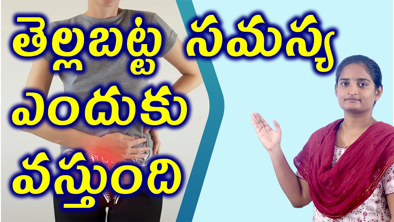 తెల్లబట్ట సమస్య ఎందుకు వస్తుంది Structure Of Function White Discharge Homeopathy Treatment Medicine