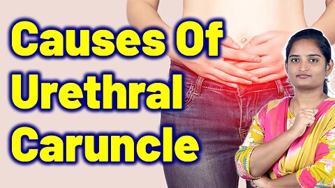 Risk Factors & Causes Of Urethral Caruncle, Urethral Hyperplastic Lesion, Urethral lump. Homeopathy
