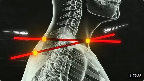 The JFK Assassination: The Autopsy Controversy | 11/16/2025