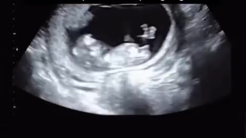 🤰‍♀️😂 The Craziest Way to Become a Mom! | FunFM