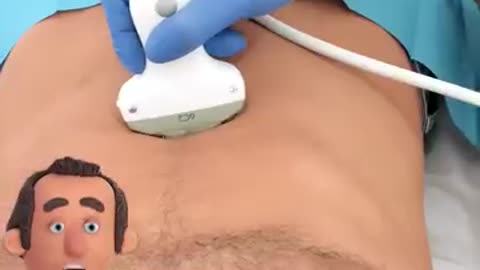 What's a Hernia??