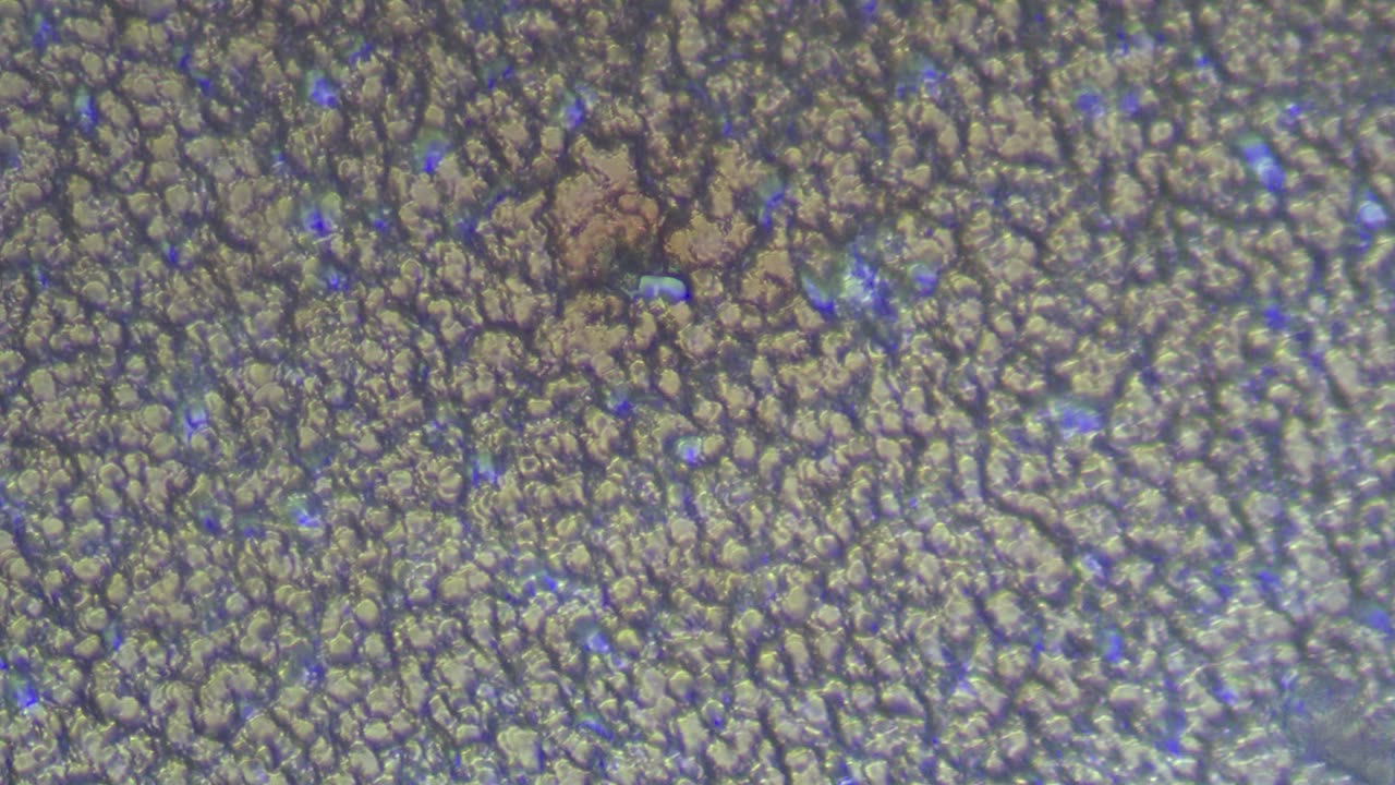 Bloody Zit Under a Microscope