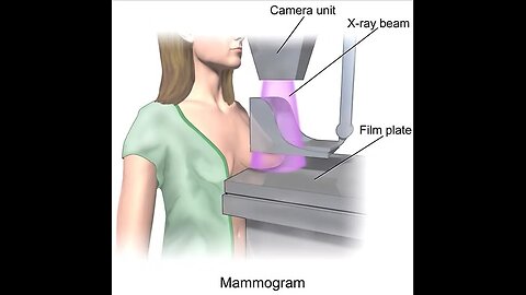 Dr. Barbara O’Neil on Pap Smears, Mammograms, and Colonoscopies