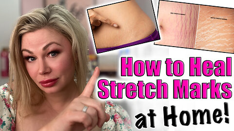 How to Heal Stretch Marks at Home! Code Jessica10 Saves you money! Wannabe beauty guru