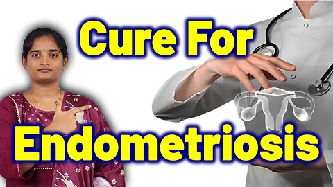 Best Cure For Endometriosis | Female Womb Lining Problem Treatment Cure Medicine | Gynaecology Women