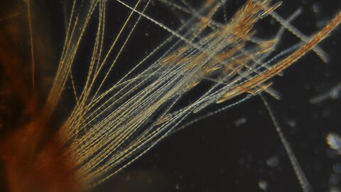 Possible Growth Found On A House Fly