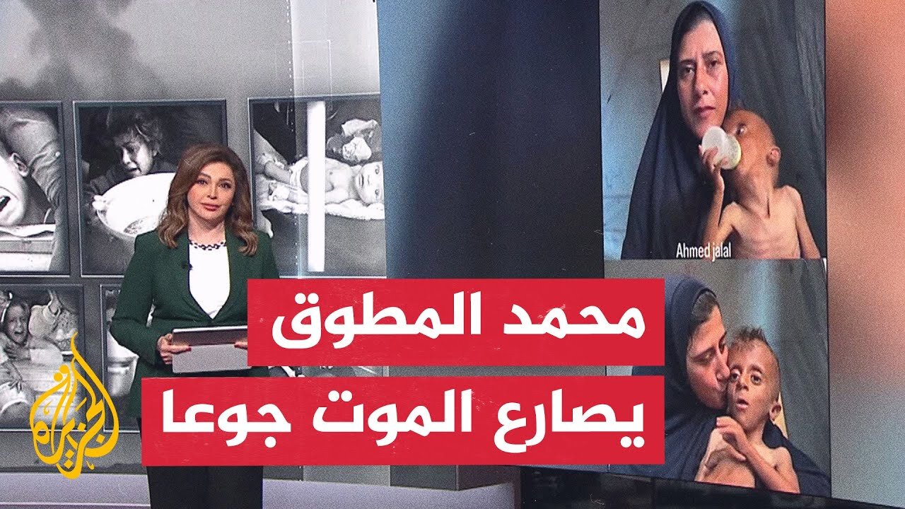 غابت ملامح الطفولة في غزة.. محمد المطوق لم يتجاوز العامين ويصارع الموت جوعا