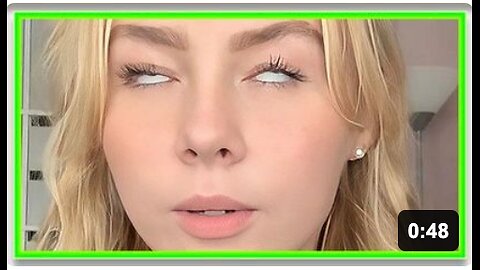 Docs baffled by woman's sudden & bizare eye problem