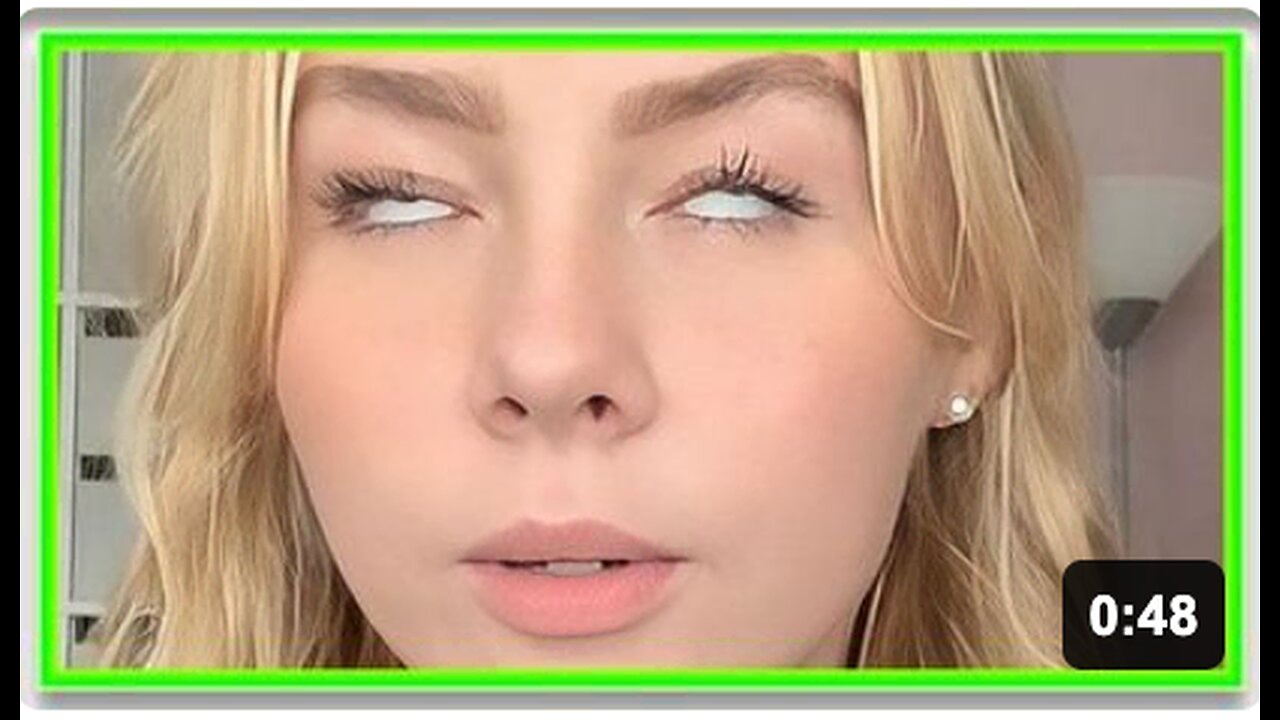 Docs baffled by woman's sudden & bizare eye problem