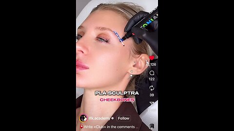 Pls use a 25g needle 1.5” or 23 or 25g cannula