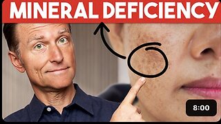 The #1 Deficiency behind Aging Spots