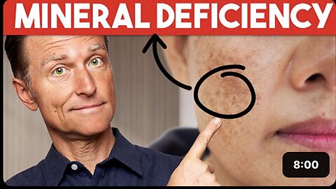 The #1 Deficiency behind Aging Spots