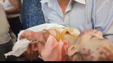 The last hug and embrance between a Palestinian Father and his child killed by IOF.