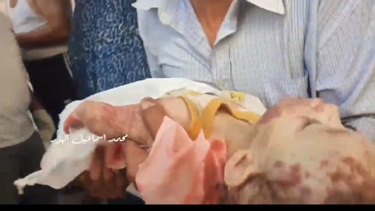 The last hug and embrance between a Palestinian Father and his child killed by IOF.