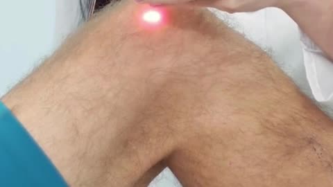 💥 Shockwave Therapy in Maple Ridge | Golden Maple Physiotherapy 💥