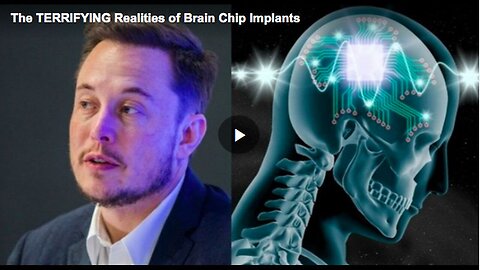 "Frightening Truths About Brain Chip Implants"