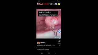 Caution Graphic Content Cancer Tumors Show Parasites As The Cause