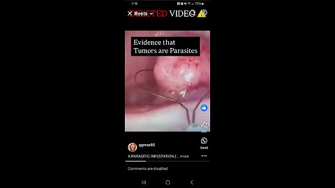 Caution Graphic Content Cancer Tumors Show Parasites As The Cause