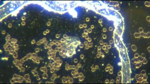 микророботы в крови неуколотых