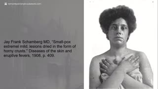 The Truth About Smallpox – A Fraudulent Scheme to Justify Vaccines