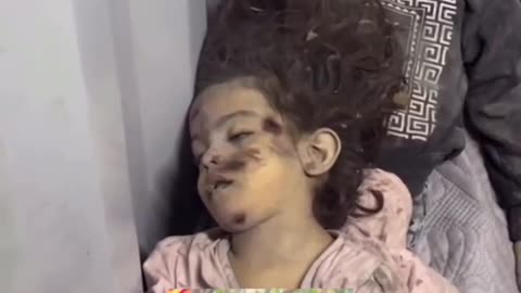Gaza IDF military attacks war crimes ect, 10/31/25 18+ Graphic warning Children