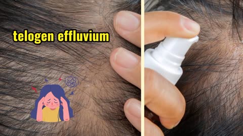 1 TSP of THIS will Improve Your Iron & Hemoglobin Naturally