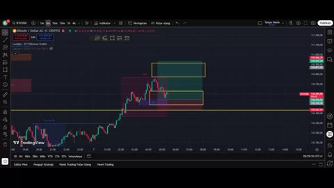 Top 5 Scalping Tips Every Beginner Must Know