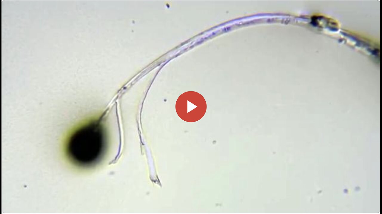 GRAPHENE (like) CRYSTALS In DENTISTRY LOCAL ANESTHETIC