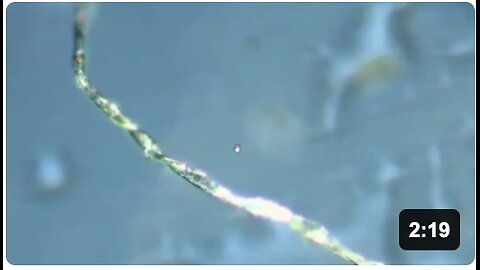 A microscopic examination of nanobots and hydrogel structures developing in vaccinated individuals.