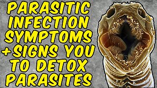 Parasitic Infection Symptoms That Are a Sign You Need to Detox Parasites!