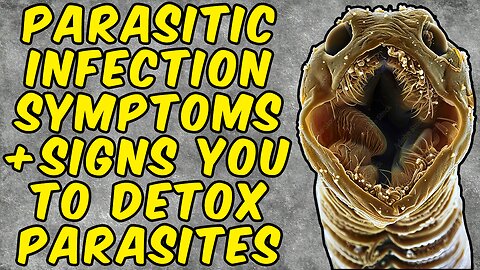 Parasitic Infection Symptoms That Are a Sign You Need to Detox Parasites!