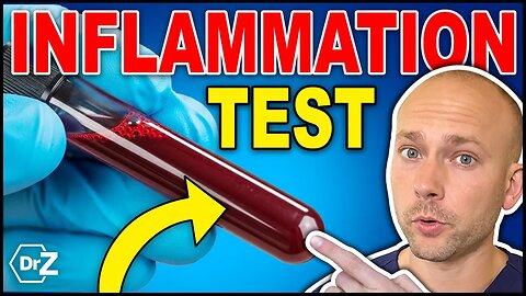 How to MEASURE Inflammation In Your Body - Simple In Home Test!