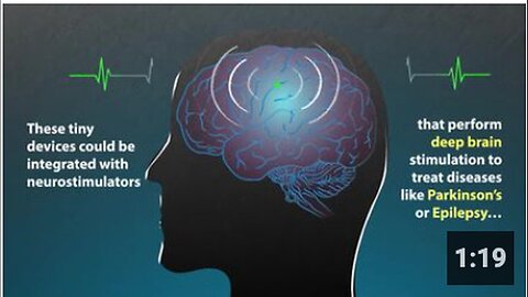 "MIT's Wireless System Powers and Communicates with In-body Nanotech (2018)"