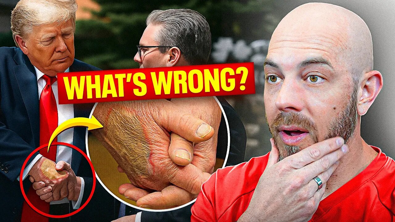 Dermatologist Explains Trump’s Hand