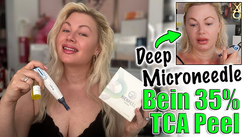 Deep Microneedling with Bein 35% TCA Peel! AceCosm.com and code Jessica10 Saves