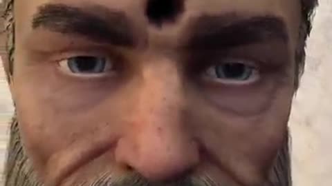 Soldier Survives Bullet To The Brain