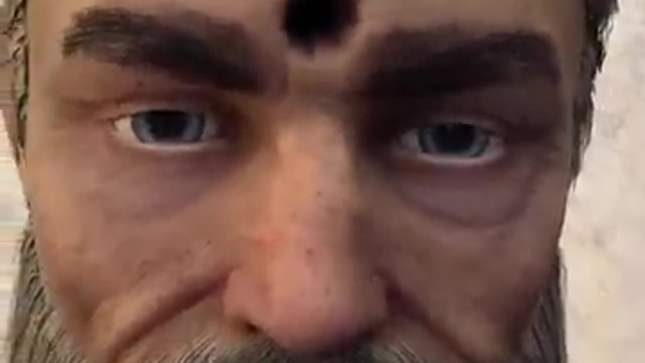 Soldier Survives Bullet To The Brain