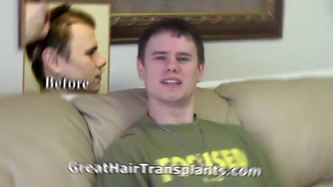 Great Hair Transplants: Dr. Brett Bolton on Premature Balding in Young Men