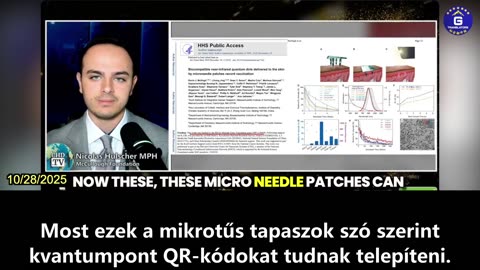【HU】A Gates Alapítvány legújabb bőr alatti implantátuma képes tárolni az oltási adatokat