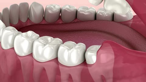 Top Dental X-Ray Services in Bay Ridge, Brooklyn NY