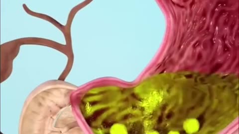 Health Food
