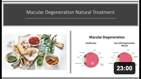 Macular Degeneration Natural Treatment