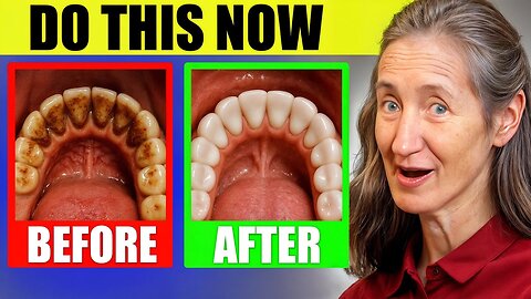 Barbara O'Neill | DENTISTS HATE THIS! REVERSES Tooth Decay & Heals Teeth