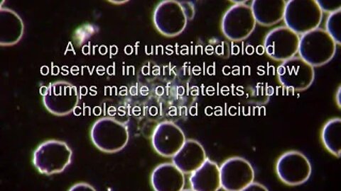 "Cardiovascular Diseases & Thrombosis: An Insight"