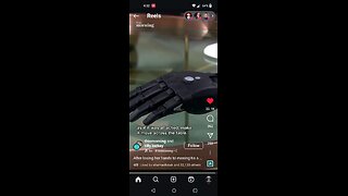 The New Prosthetic Tech