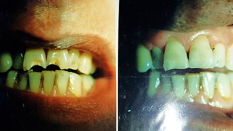 Dr. Michael Lambourne Dentistry