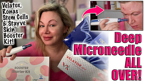 Deep Microneedle ALL OVer w/ Velatox, Ronas & Stayve Skin Booster! AceCosm code Jessica10 saves