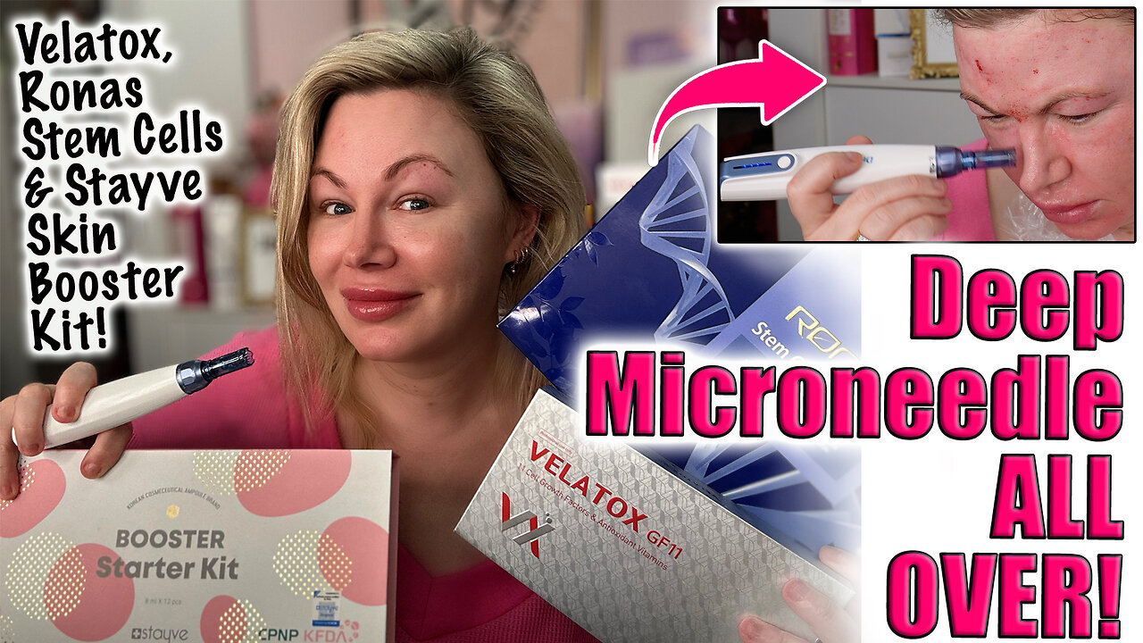 Deep Microneedle ALL OVer w/ Velatox, Ronas & Stayve Skin Booster! AceCosm code Jessica10 saves