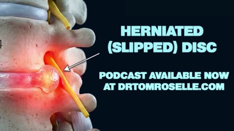 [PODCAST] Can A Slipped Disc Be Cured Without Surgery & Steroid Injections?