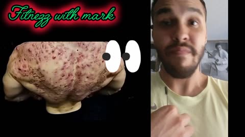 Steroids.....is it worth it?